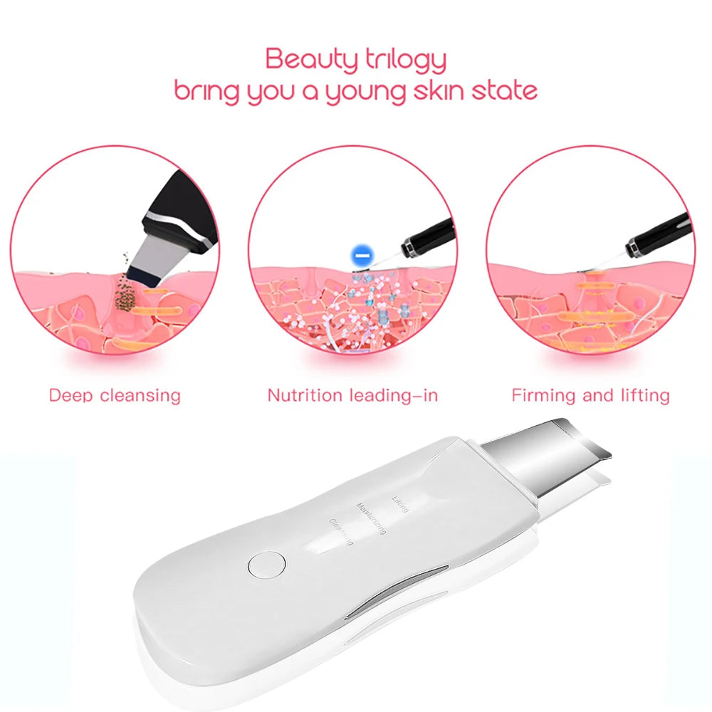 Spatule Faciale à Ultrasons — Nettoyant, Anti-Points Noirs & Masseur | MDN Store 25