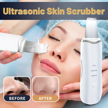 Epurateur de Peau Ultrasons Nettoyeur Pores Points Noirs EMS Visage | MDN Store 25