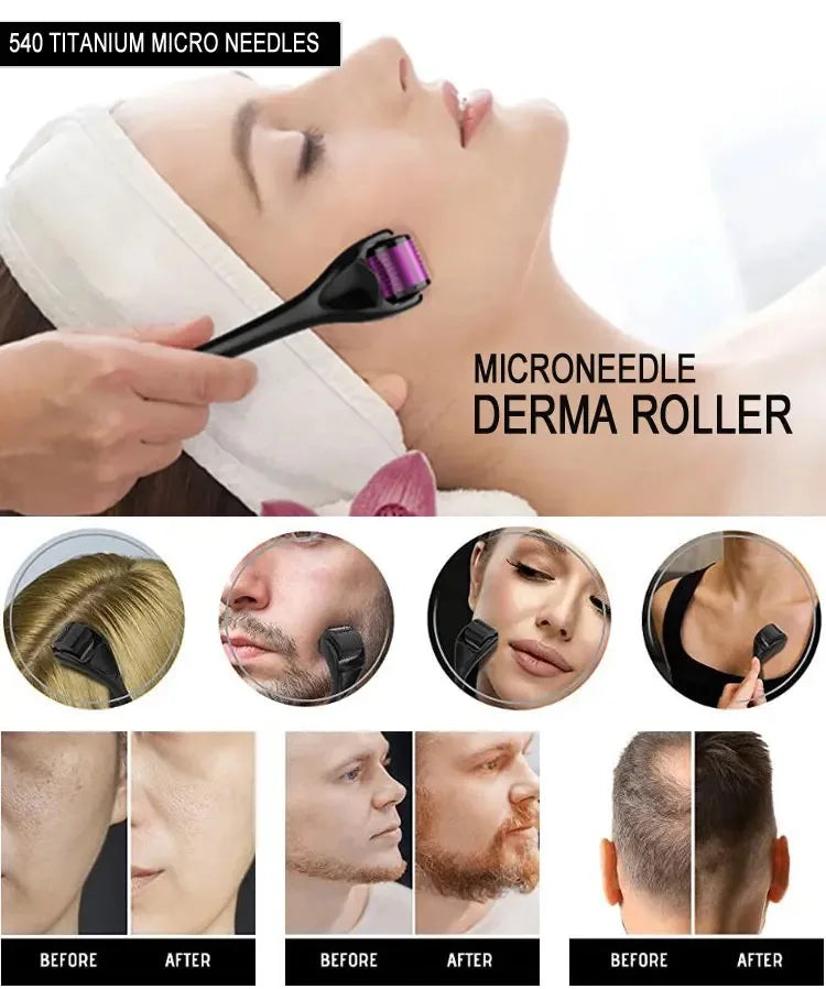 Derma Roller 540 Micro-Aiguilles Grade Médical 1.0mm | MDN Store