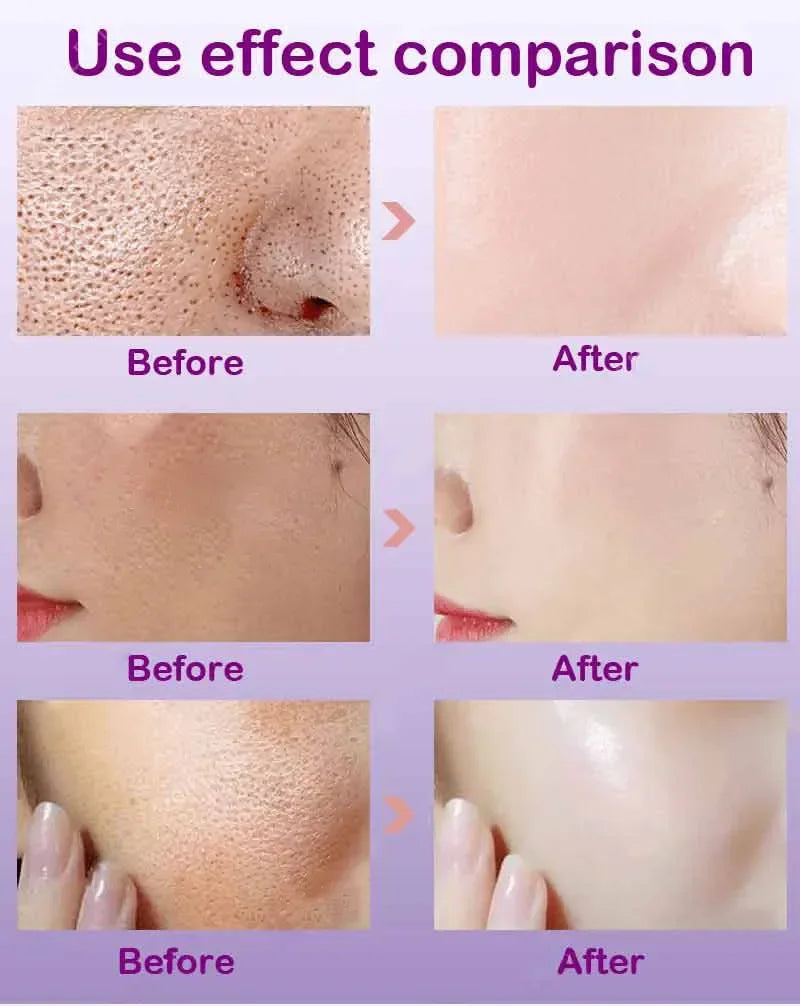 Sérum Visage Rétinol Niacinamide Resurfaçant Pores Anti-Imperfections | MDN