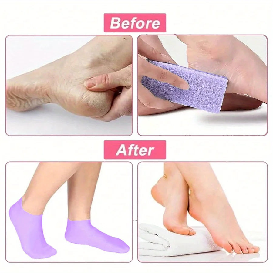 Chaussettes Hydratantes Silicone - Pieds Secs & Talons Craquelés Femme | MDN Store 25