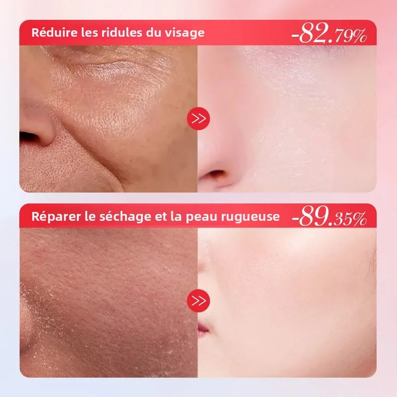 Sérum Visage Niacinamide Anti-Taches Éclaircissant Hydratant | MDN Store