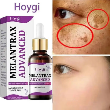 Sérum Visage Niacinamide Vitamine B3 Anti-Taches Éclat Hydratant | MDN Store 25