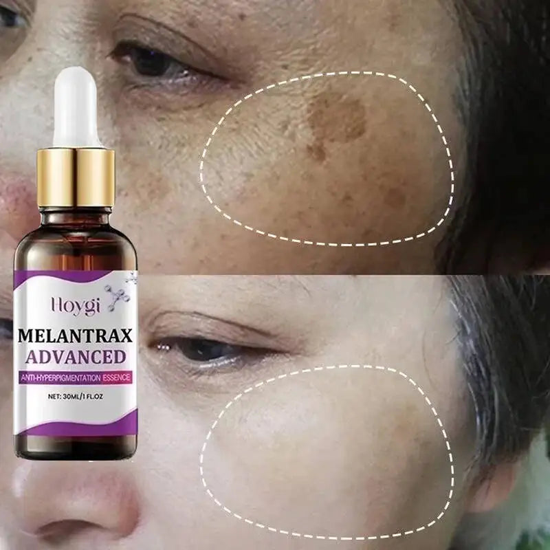 Sérum Visage Niacinamide Vitamine B3 Anti-Taches Éclat Hydratant | MDN Store 25
