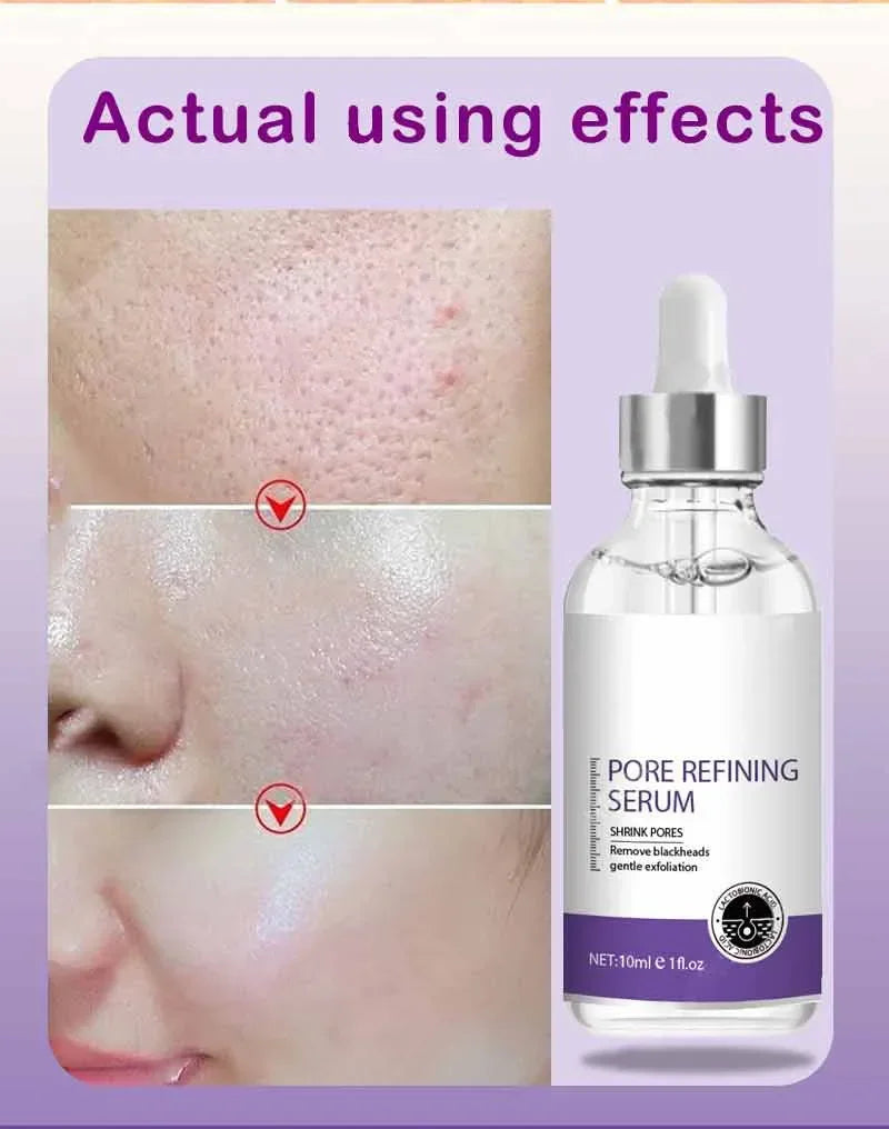 Sérum Visage Rétinol Niacinamide Resurfaçant Pores Anti-Imperfections | MDN Store