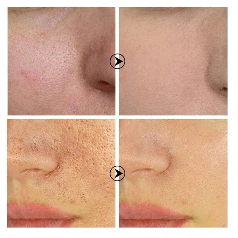 Sérum Visage Rétinol Niacinamide Resurfaçant Pores Anti-Imperfections | MDN Store