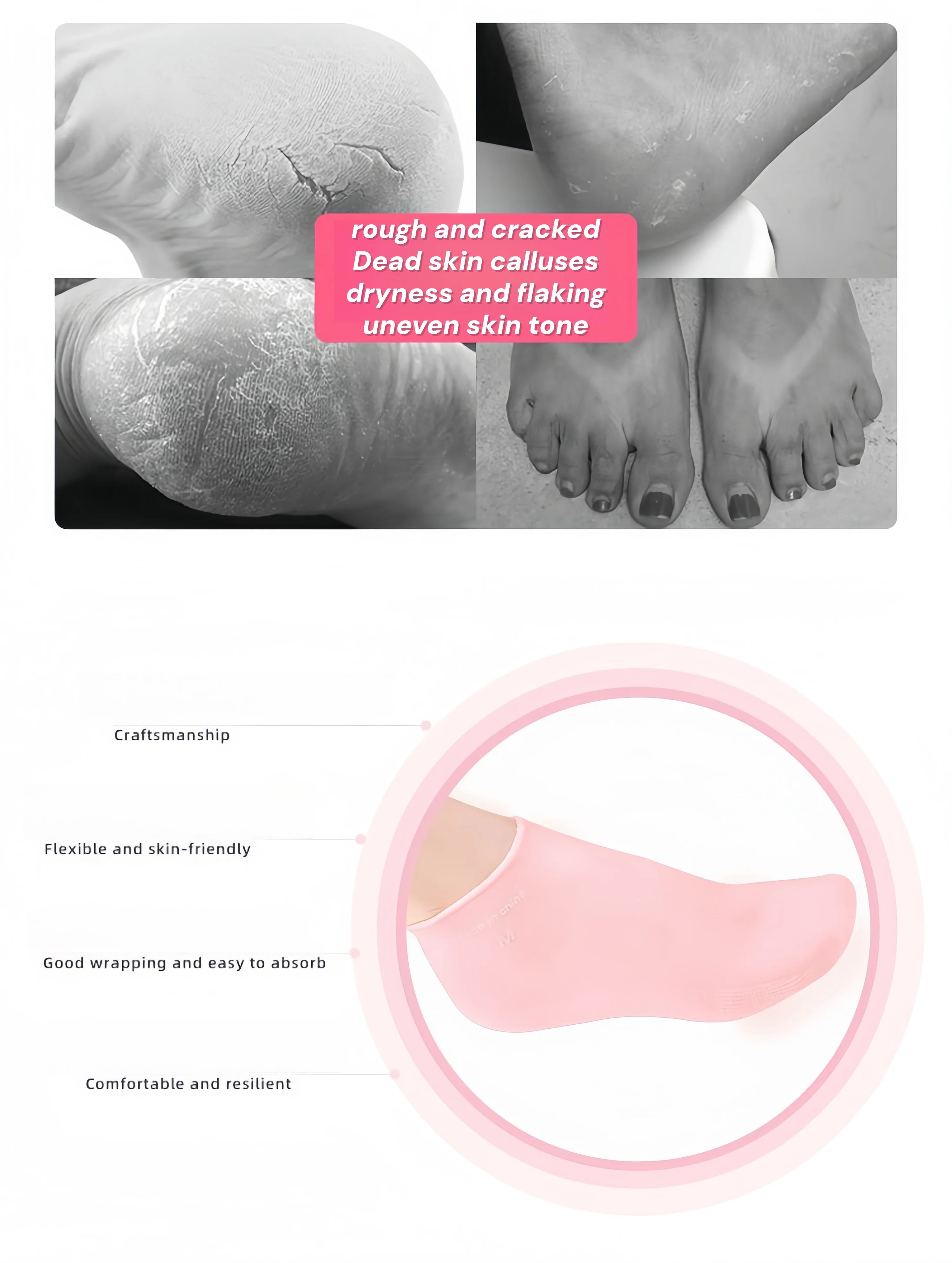 Chaussettes Hydratantes Silicone - Pieds Secs & Talons Craquelés Femme | MDN Store 25