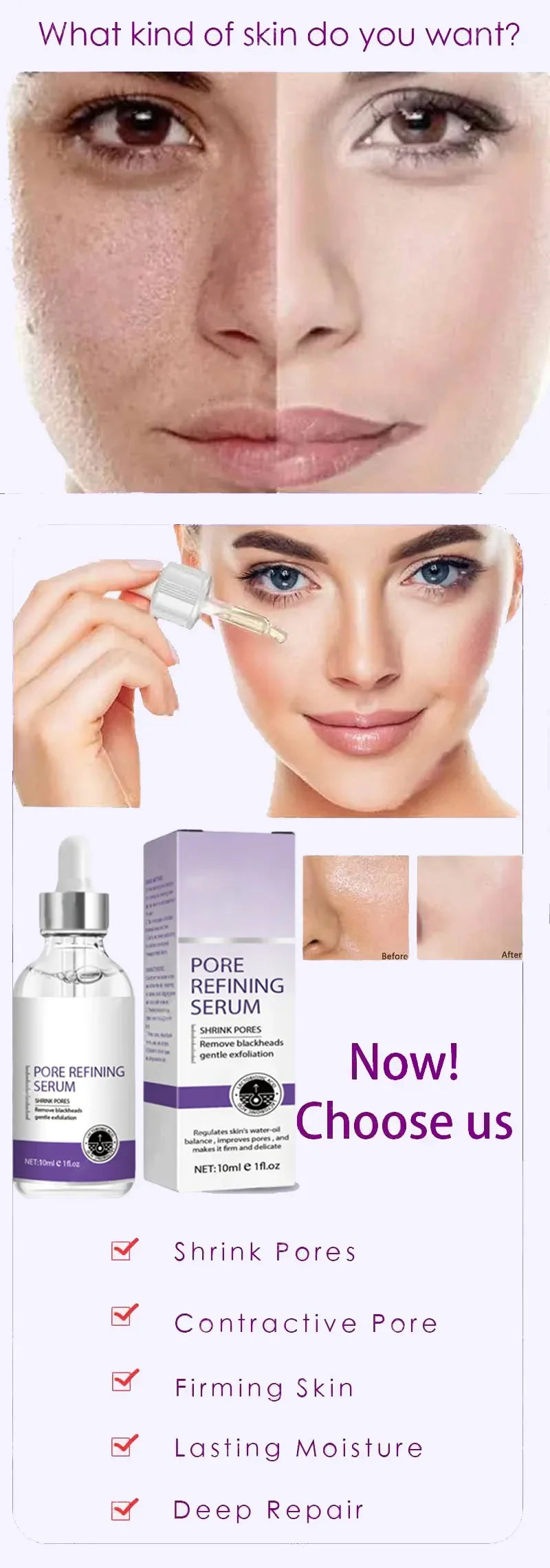 Sérum Visage Rétinol Niacinamide Resurfaçant Pores Anti-Imperfections | MDN Store