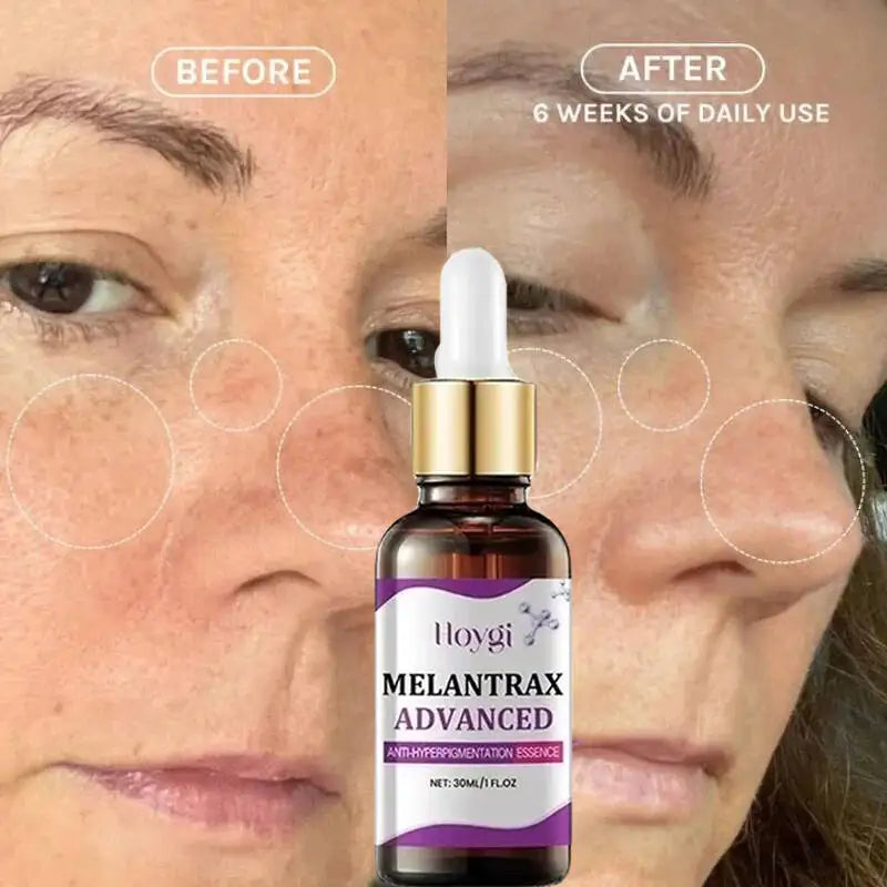 Sérum Visage Niacinamide Vitamine B3 Anti-Taches Éclat Hydratant | MDN Store 25