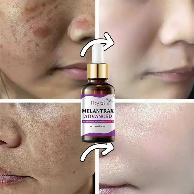 Sérum Visage Niacinamide Vitamine B3 Anti-Taches Éclat Hydratant | MDN Store 25