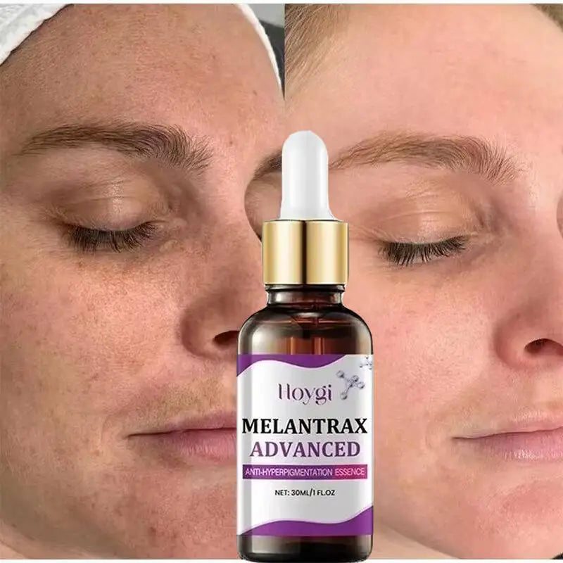 Sérum Visage Niacinamide Vitamine B3 Anti-Taches Éclat Hydratant | MDN Store 25