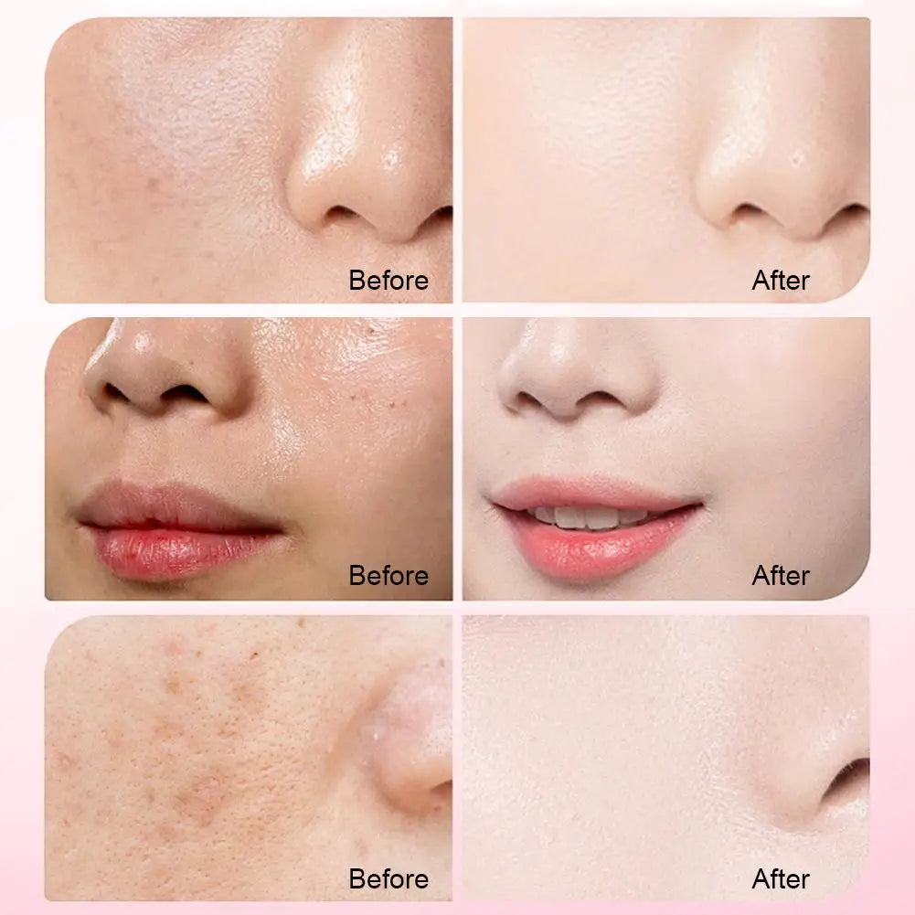 Capsules Essence Niacinamide Visage Hydratant Anti-Taches 21x1.2ml | MDN Store