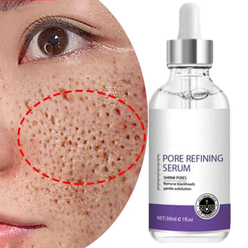 Sérum Visage Rétinol Niacinamide Resurfaçant Pores Anti-Imperfections | MDN Store
