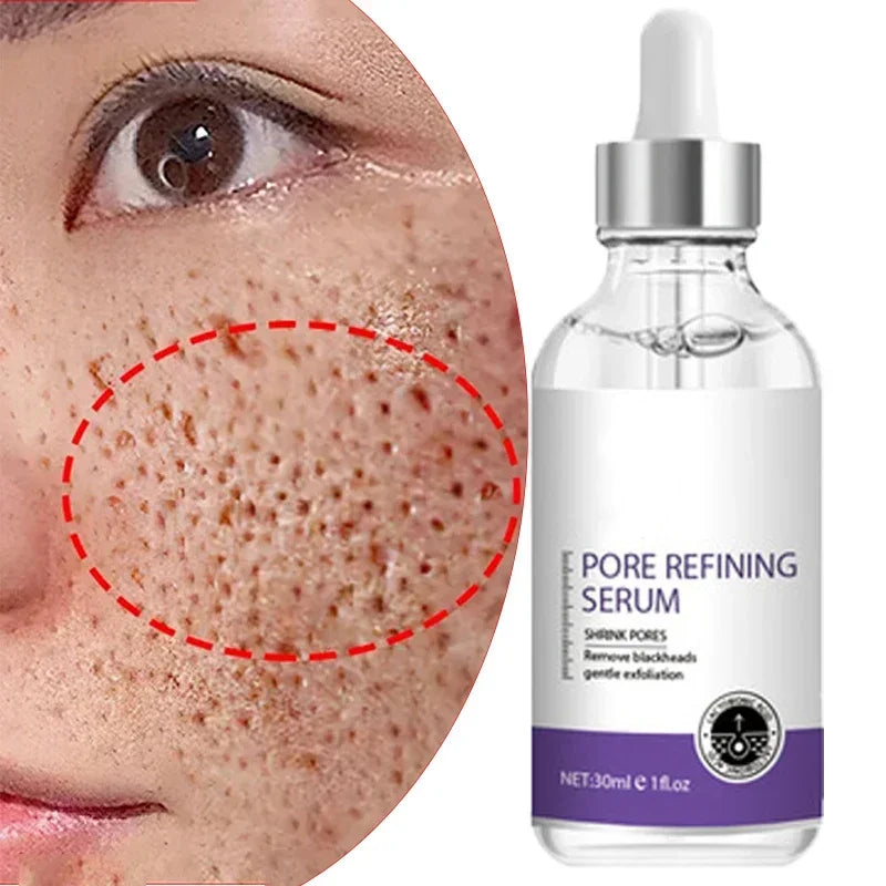 Sérum Visage Rétinol Niacinamide Resurfaçant Pores Anti-Imperfections | MDN Store