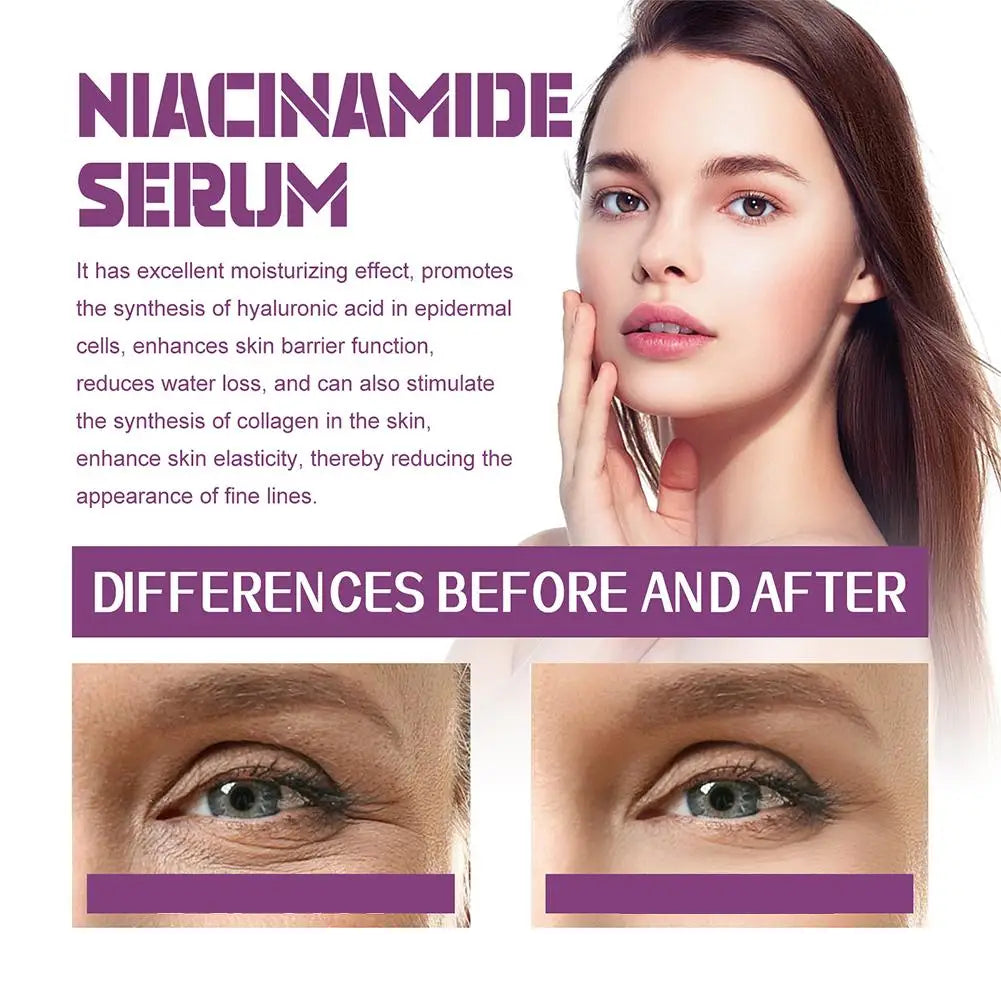 Sérum Visage Niacinamide 20% Haute Concentration Anti-Taches Raffermissant | MDN