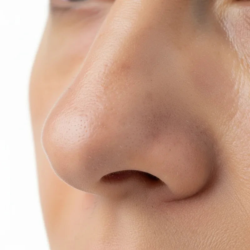 image comparison after